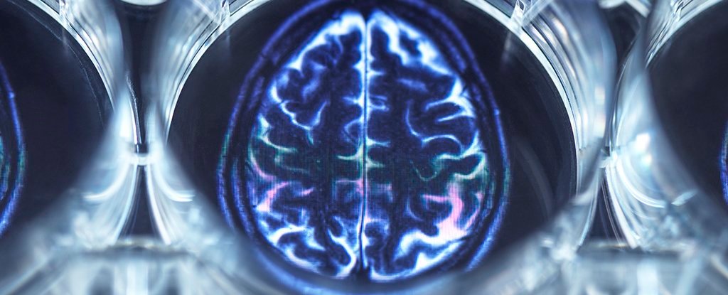 Scientists Reveal How a Bigger Brain Network Can Improve Depression Treatment