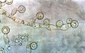 Top Experts Warn Why Ignoring Fungal Disease Resistance Could Be…