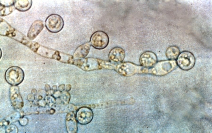 Top Experts Warn Why Ignoring Fungal Disease Resistance Could Be a Massive Mistake
