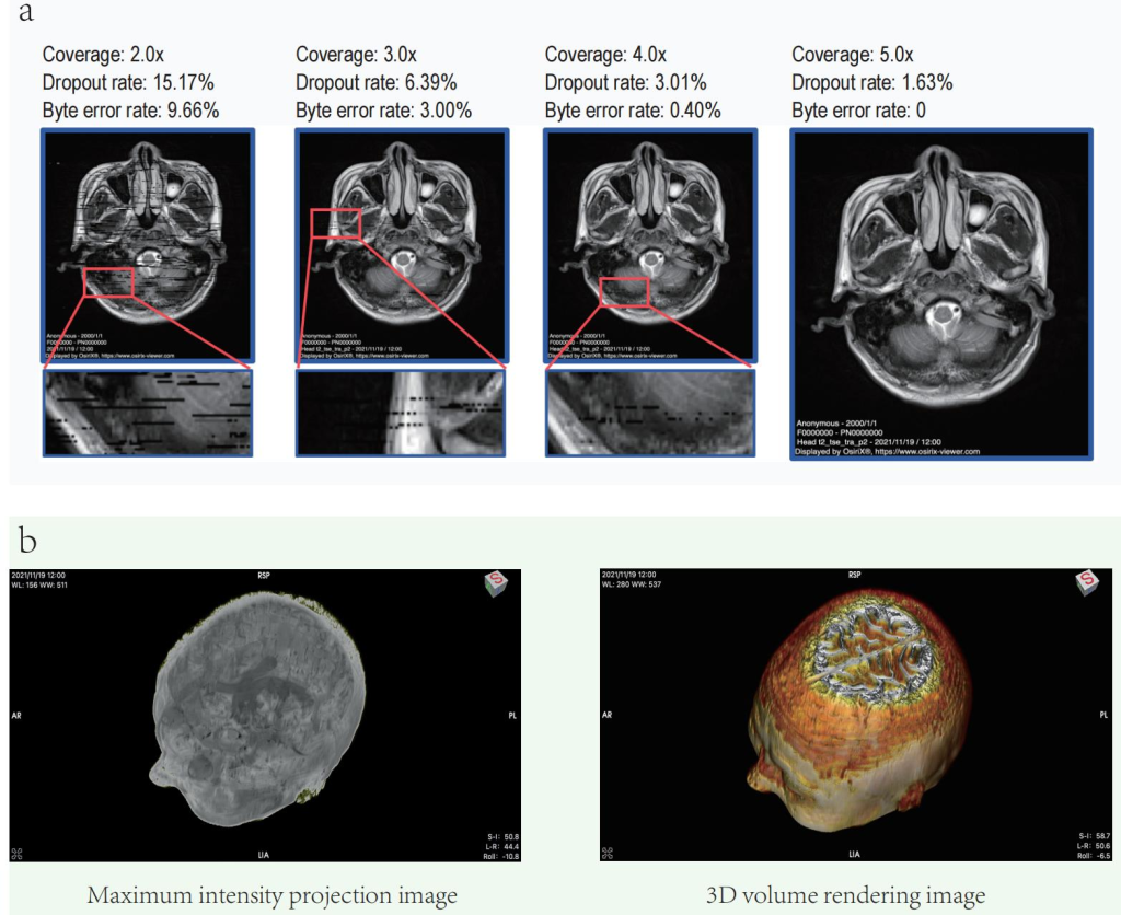 Scientists Successfully Convert 11.28 MB of Brain MRI Data into 250,000 DNA Sequences