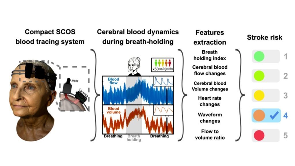 First-Ever Noninvasive Stroke Prediction Achieved with Caltech’s Laser Headset